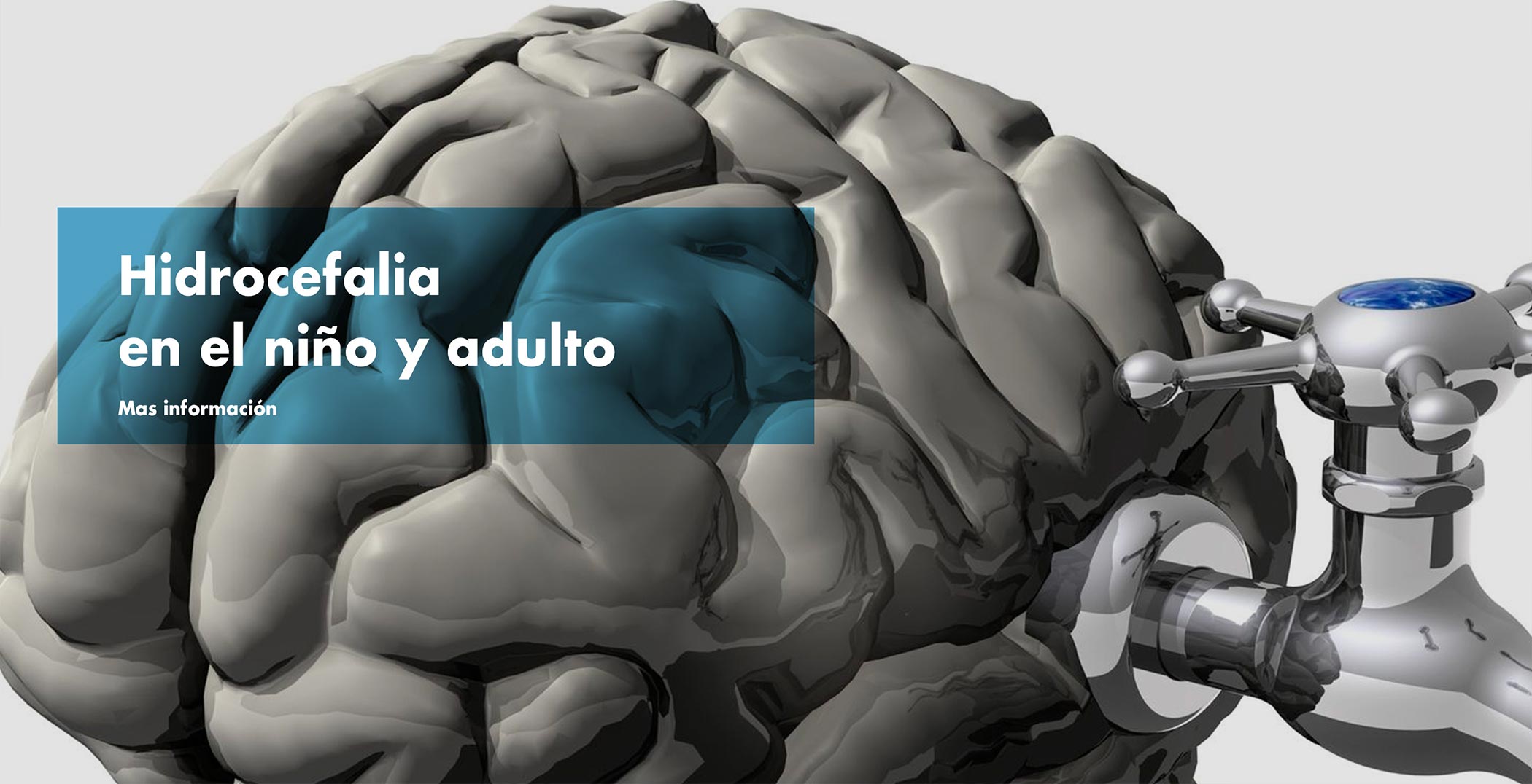 Hidrocefalia en el niño y adulto