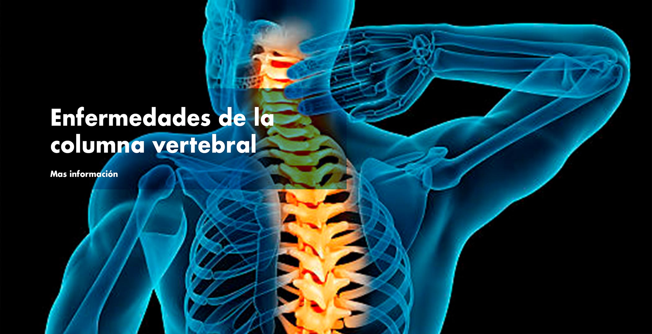 Enfermedad de la columna vertebral